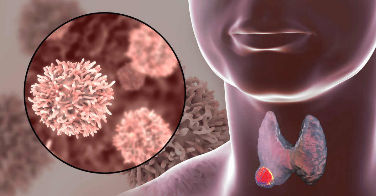 What is the Thyroid Gland thumb