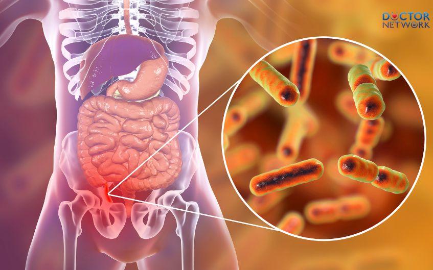 dau-ruọt-thua-ben-nao-1 in which side is appendicitis pain 1