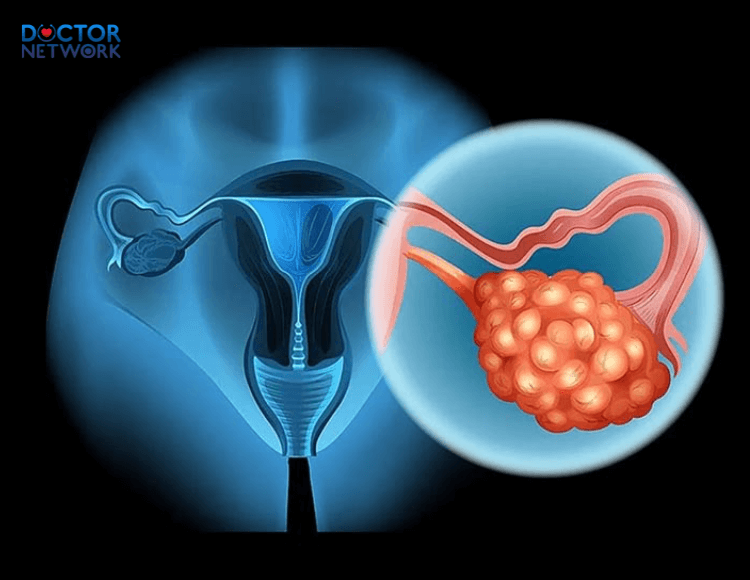 are ovarian cysts dangerous 1