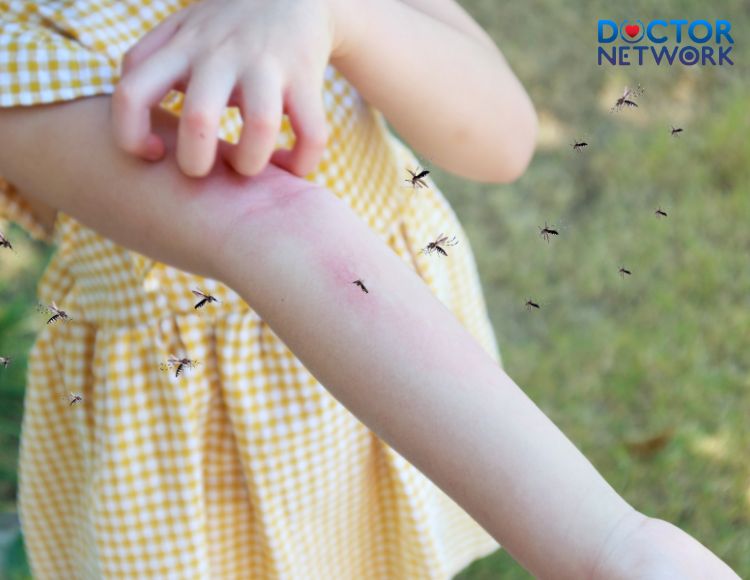 5 Signs Of Dengue Fever Recovery You May Not Know Doctor Network