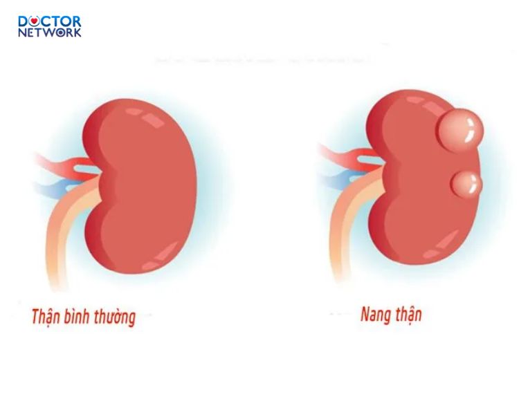 Nang-than-co-nguy-hiem-khong-1