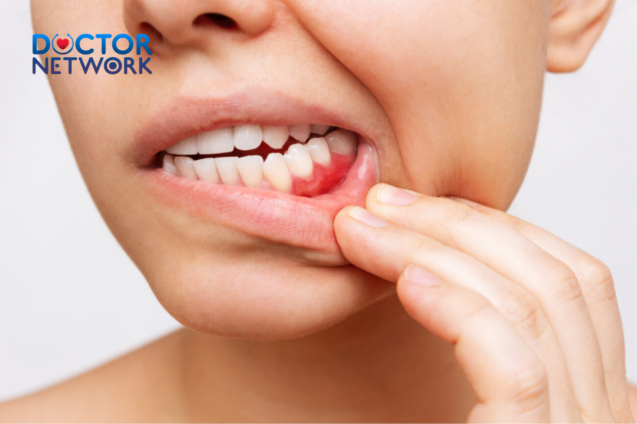 why do my gums bleed when i floss