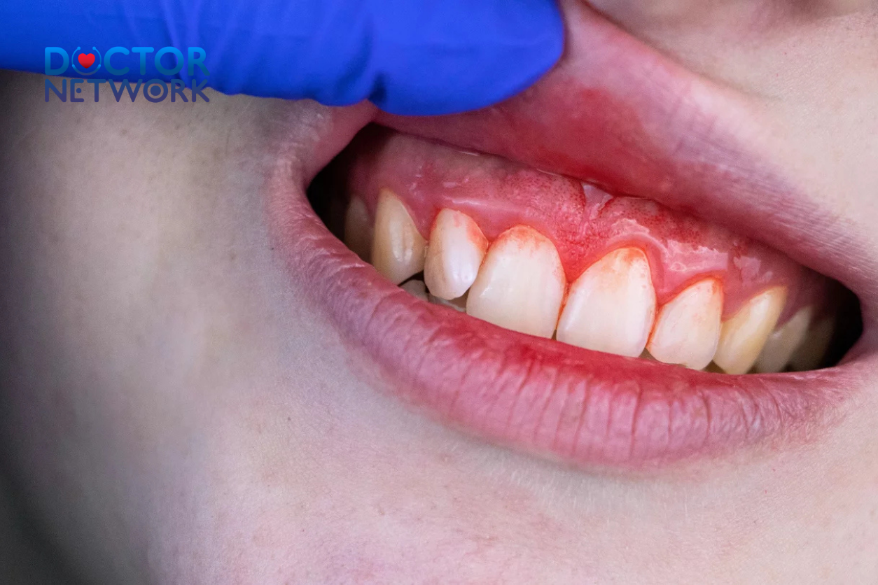 why do my gums bleed when i floss