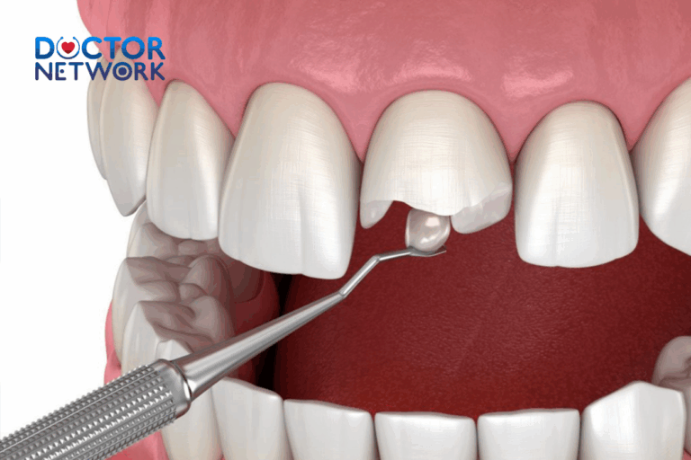 how to fix a cracked tooth naturally
