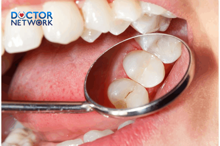 why does my tooth filling hurt after months