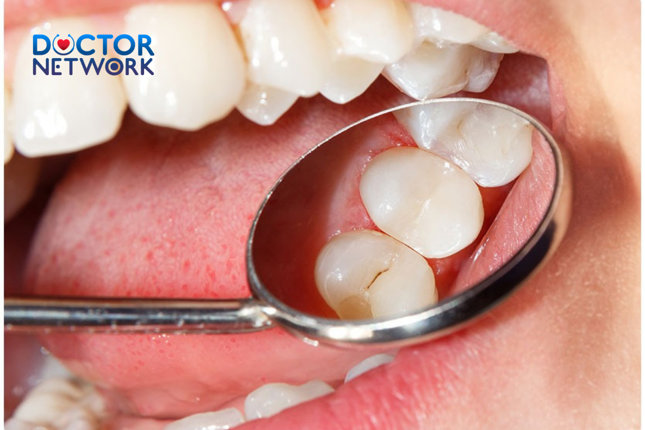 Why Does My Tooth Filling Hurt After Months? Better Understanding Delayed Dental Pain 4 why does my tooth filling hurt after months
