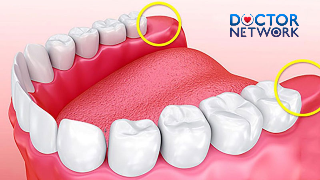 Why Experts Now Say Not To Remove Your Wisdom Teeth