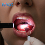 Why do people get their tonsils removed