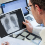 can you live with one lung
