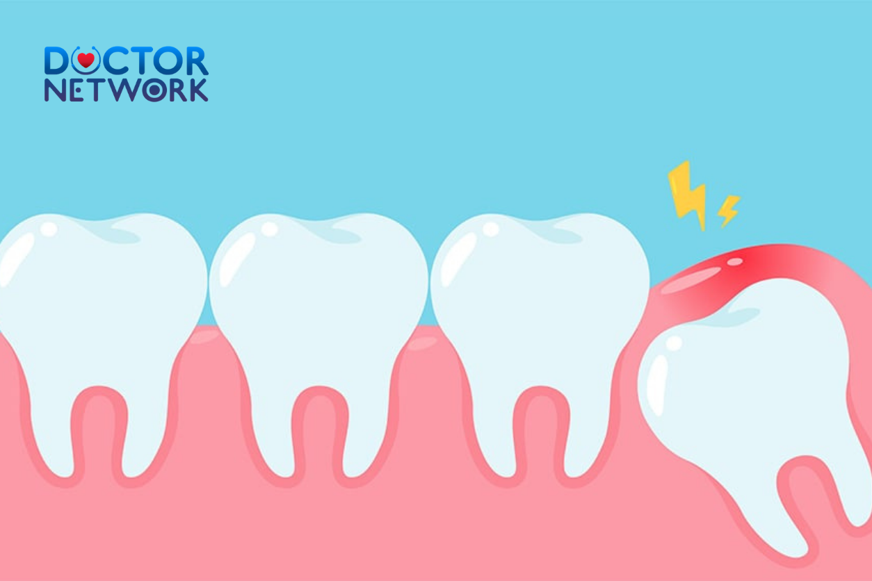 Can Wisdom Teeth Grow Back? Separating Fact from Fiction After Extraction 4 can wisdom teeth grow back