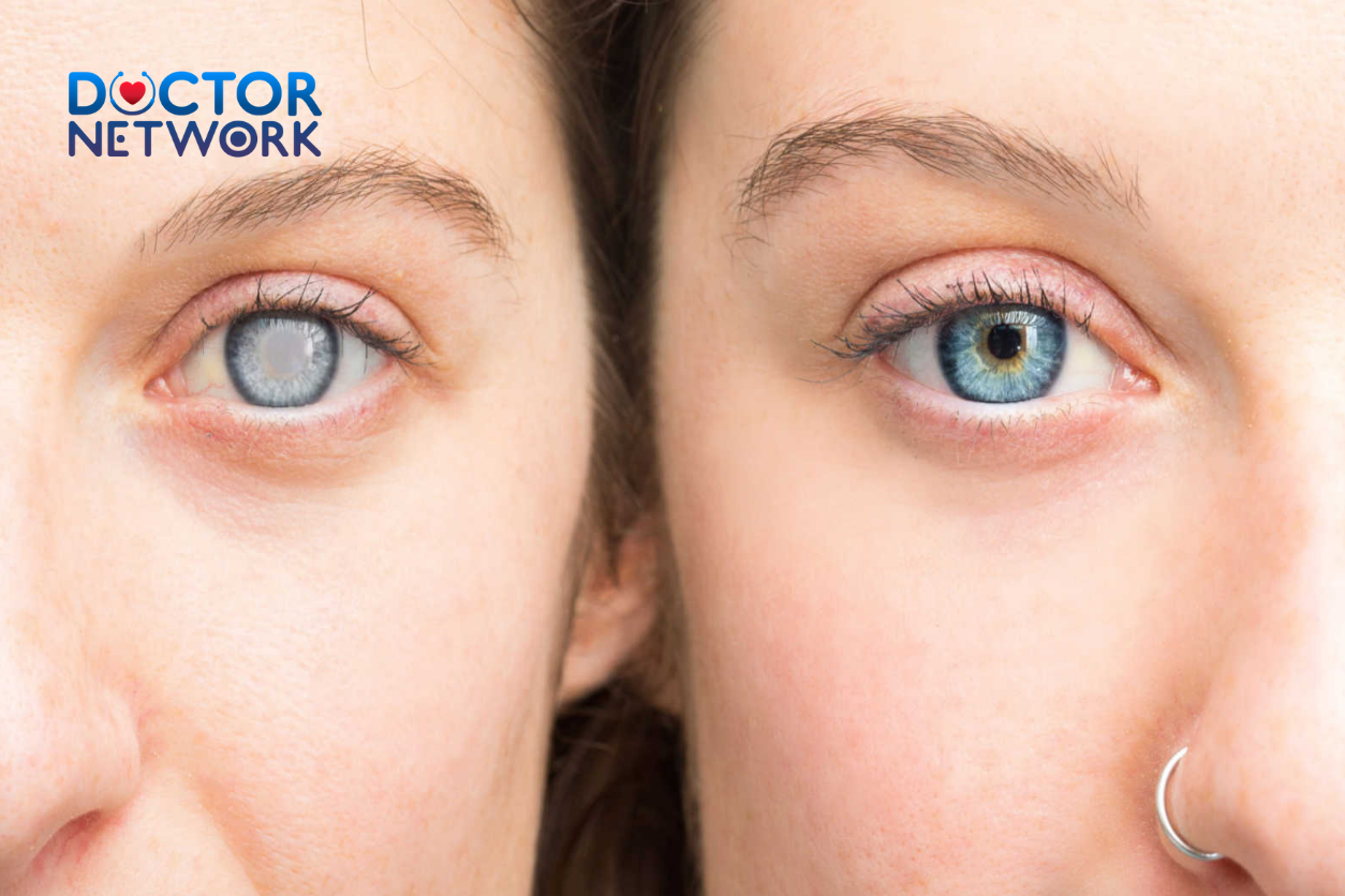 signs and symptoms of cataracts