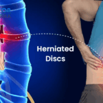signs herniated disc is healing