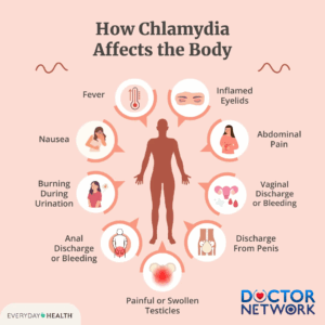 Can You Get Chlamydia From Kissing - Doctor Network