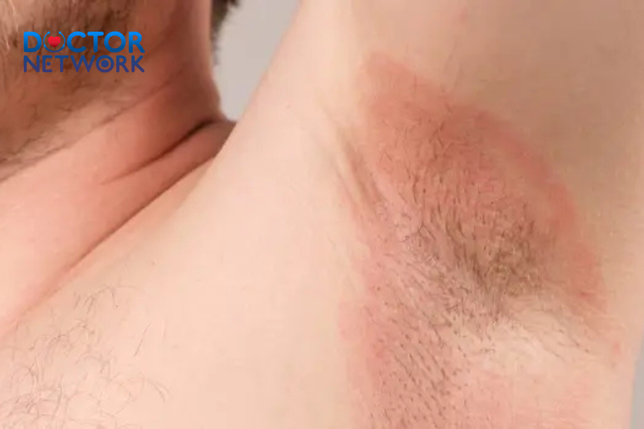 Itchy armpits bothering you? Learn about deodorant reactions, fungal infections, eczema & other causes. Find effective treatments and prevention tips. 4 n